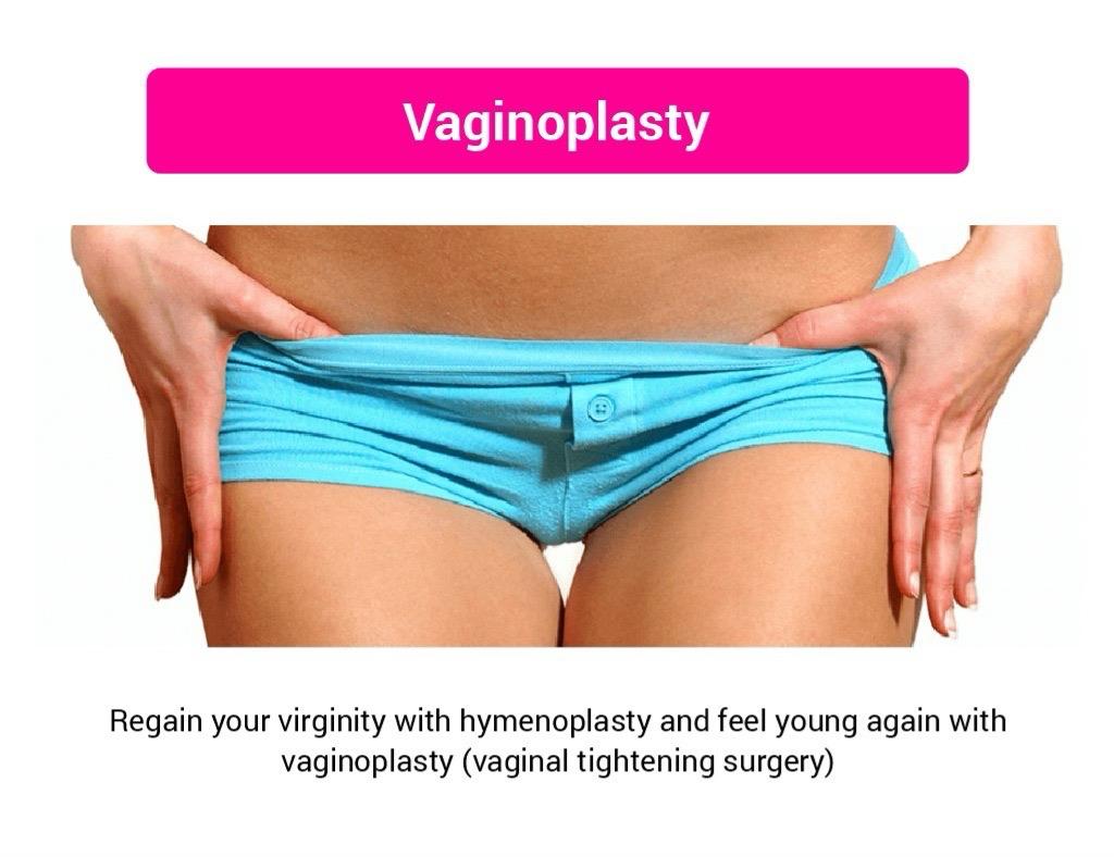 Vaginoplasty